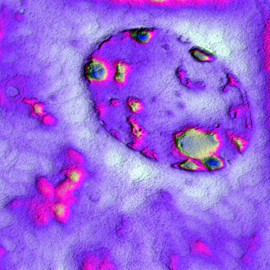 Клетки почки мыши, зафиксированные в блоке эпоксидной смолы